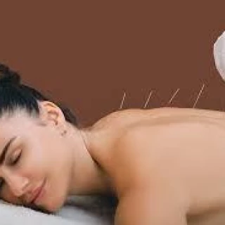 Acupuntura