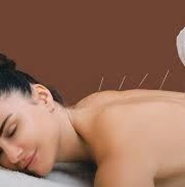 Imagem Acupuntura