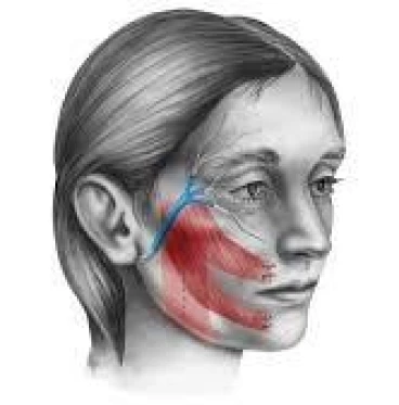 Imagem Fisioterapia na Paralisia Facial